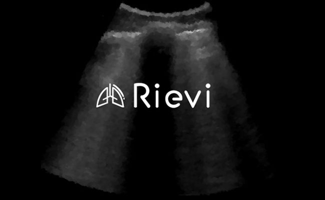 Akciğer Ultrasonunun Yorumlanmasında Yapay Zeka – Sağlık Teknoloji Haberleri